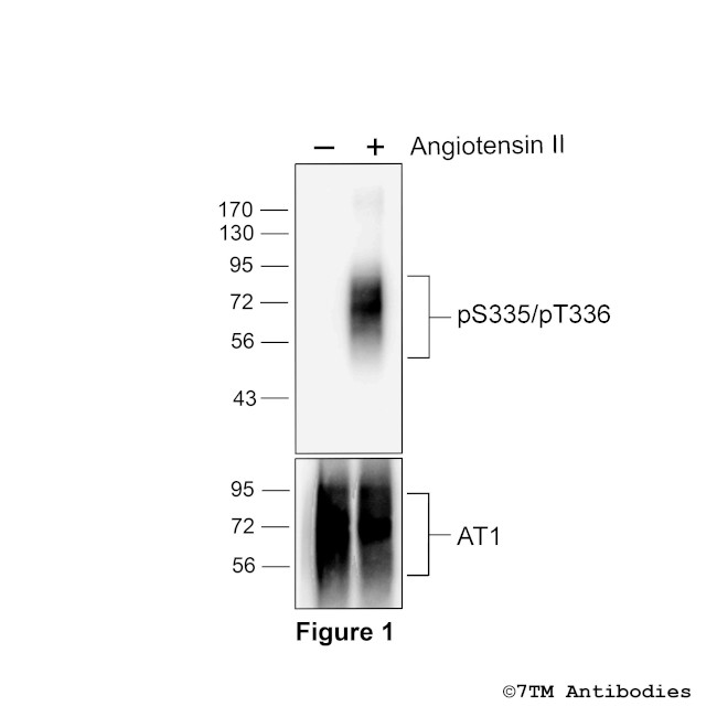 Phospho-Angiotensin Receptor 1 (Ser335, Thr336) Antibody in Western Blot (WB)