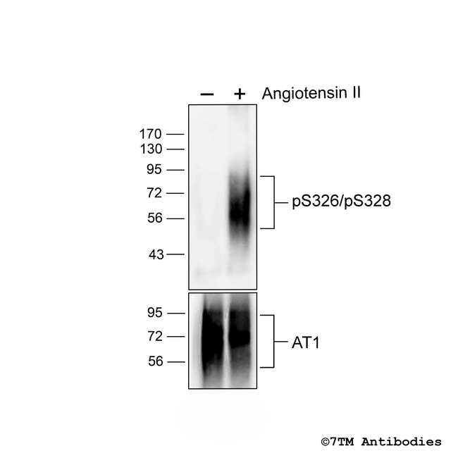 Phospho-Angiotensin Receptor 1 (Ser326, Ser328) Antibody in Western Blot (WB)