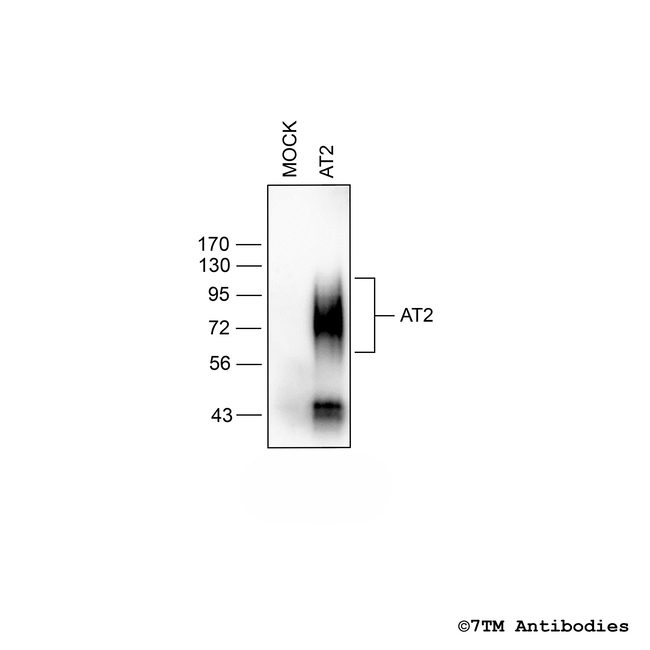 AT2 (Angiotensin Receptor 2) Antibody in Western Blot (WB)