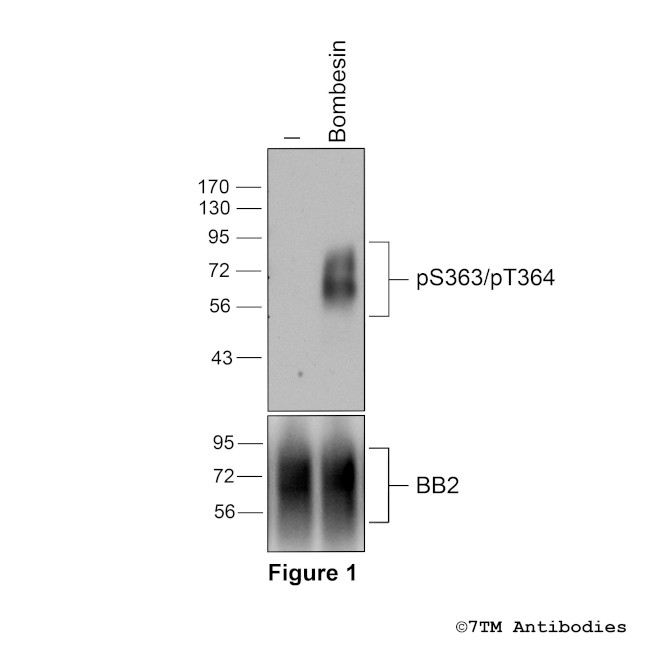 Phospho-Bombesin Receptor 2 (Ser363, Thr364) Antibody in Western Blot (WB)