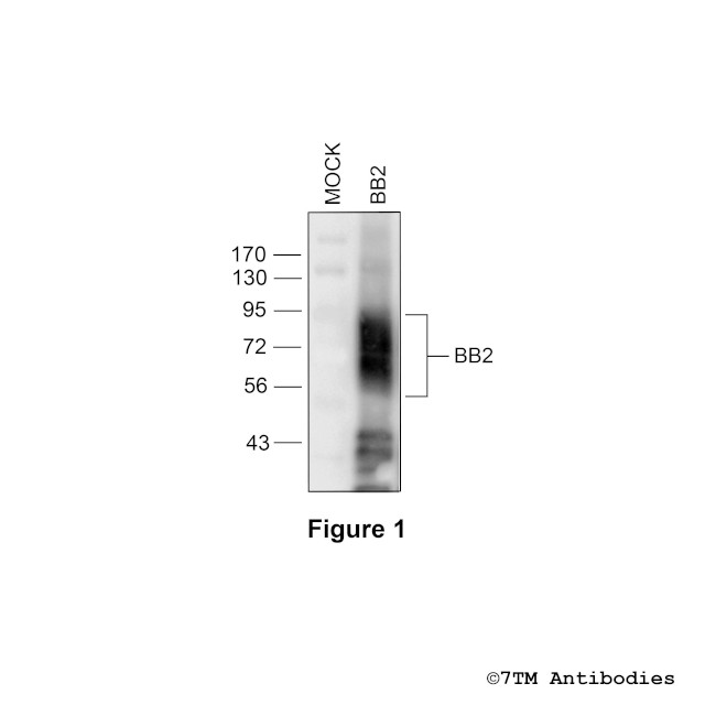 BB2, Bombesin Receptor 2 Antibody in Western Blot (WB)