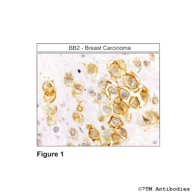 BB2, Bombesin Receptor 2/Gastrin-Releasing Peptide Receptor Antibody in Immunohistochemistry (Paraffin) (IHC (P))