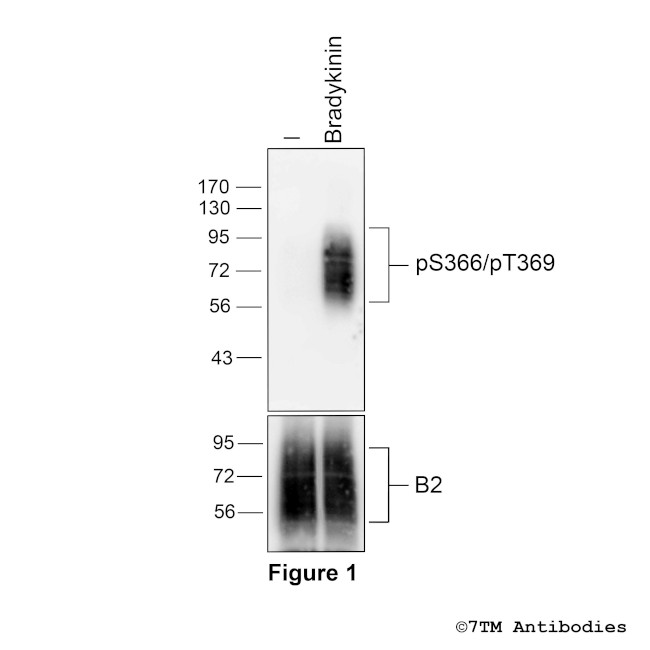 Phospho-Bradykinin Receptor 2 (Ser366, Thr369) Antibody in Western Blot (WB)