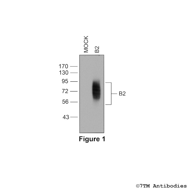 B2 (Bradykinin Receptor 2) Antibody in Western Blot (WB)