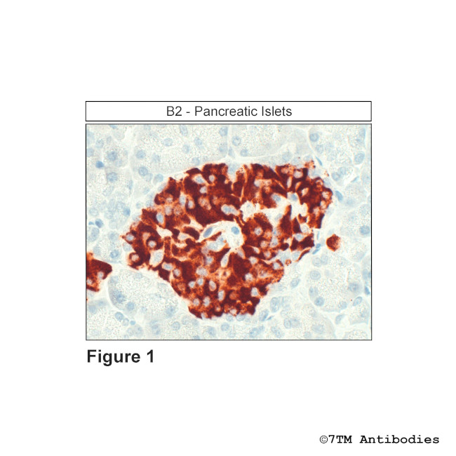 B2, Bradykinin Receptor 2 Antibody in Immunohistochemistry (Paraffin) (IHC (P))