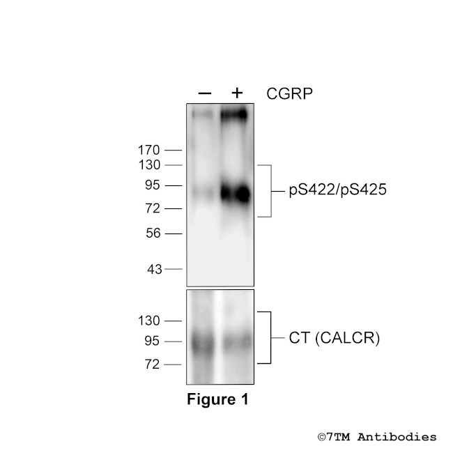 Phospho-Calcitonin Receptor (Ser422, Ser425) Antibody in Western Blot (WB)