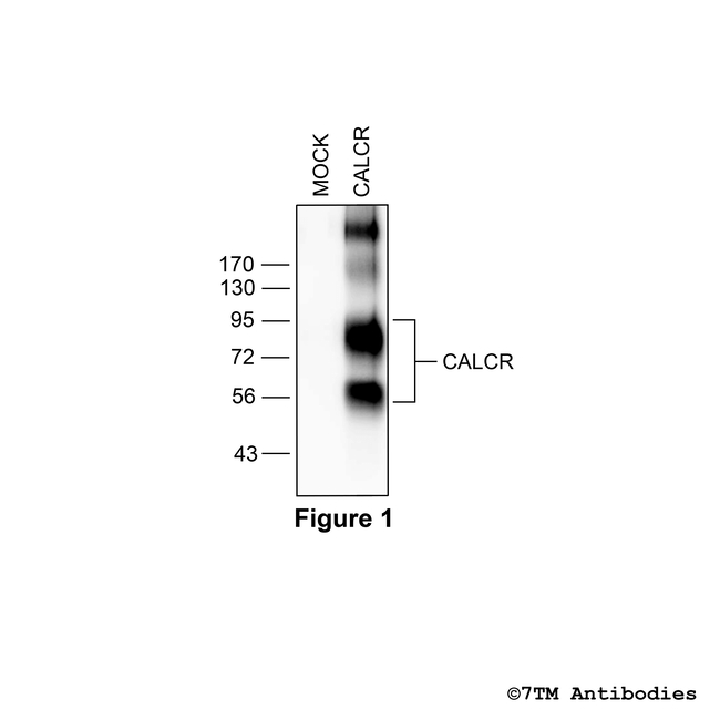 CALCR, Calcitonin Receptor-Like Receptor Antibody in Western Blot (WB)