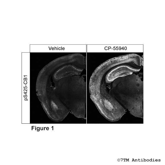 Phospho-Cannabinoid Receptor 1 (Ser425) Antibody in Immunohistochemistry (PFA fixed) (IHC (PFA))