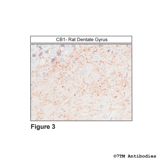 CB1, Cannabinoid Receptor 1 Antibody in Immunohistochemistry (Paraffin) (IHC (P))