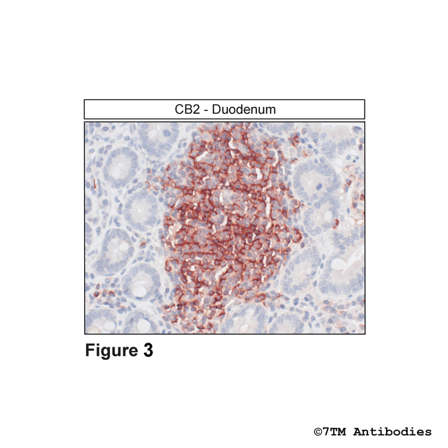 CB2, Cannabinoid Receptor 2 Antibody in Immunohistochemistry (Paraffin) (IHC (P))
