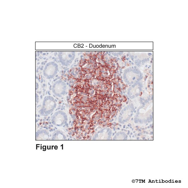 CB2 Cannabinoid Receptor 2 Antibody in Immunohistochemistry (Paraffin) (IHC (P))