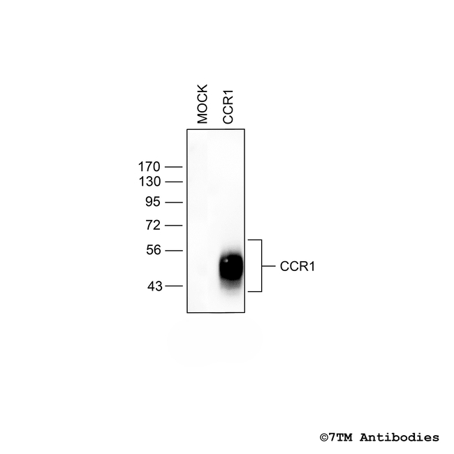 CCR1, CCR1 Chemokine Receptor Antibody in Western Blot (WB)