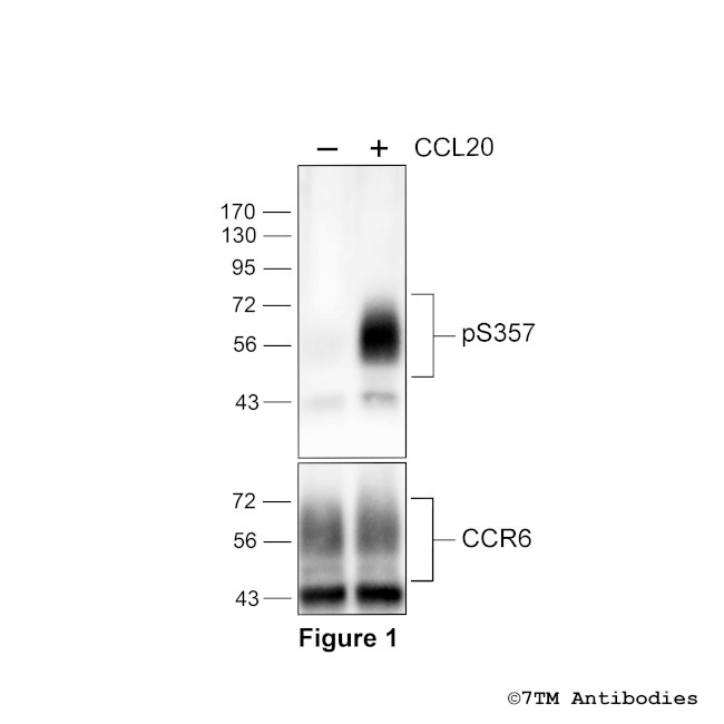 Phospho-Chemokine Receptor 6 (Ser357) Antibody in Western Blot (WB)