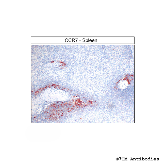 CCR7, CC Chemokine Receptor 7 Antibody in Immunohistochemistry (Paraffin) (IHC (P))