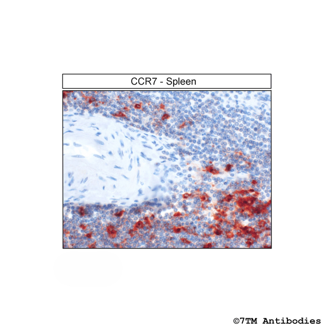 CCR7, CC Chemokine Receptor 7 Antibody in Immunohistochemistry (Paraffin) (IHC (P))