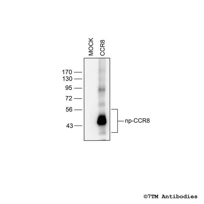 CCR8, CCR8 Chemokine Receptor Antibody in Western Blot (WB)