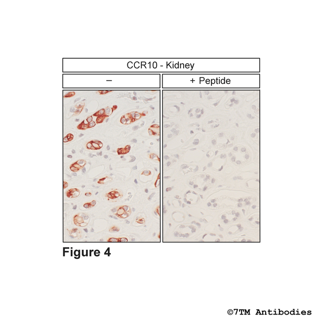 CCR10 Chemokine Receptor 10 Antibody in Immunohistochemistry (Paraffin) (IHC (P))