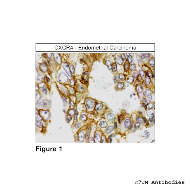 CXCR4, CXC Chemokine Receptor 4 Antibody in Immunohistochemistry (Paraffin) (IHC (P))