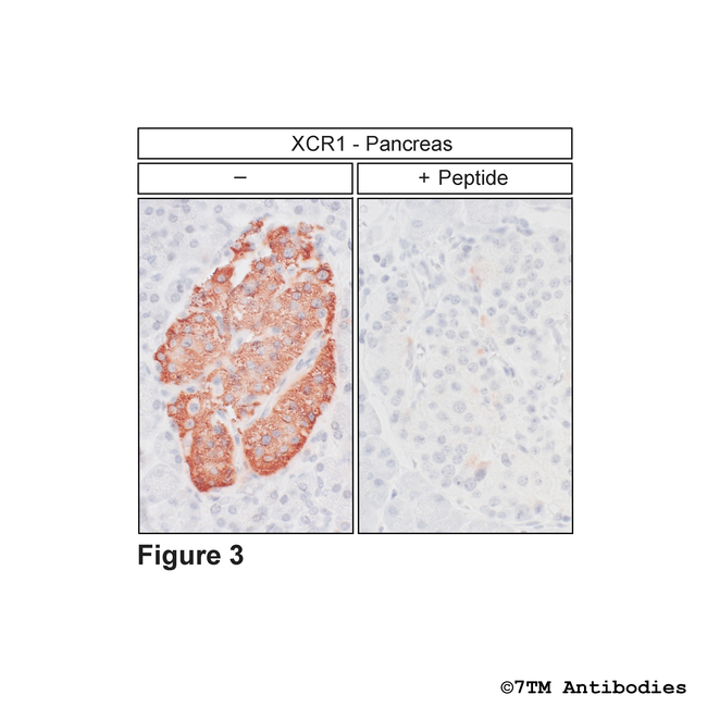XCR1, XCR Chemokine Receptor 1 Antibody in Immunohistochemistry (Paraffin) (IHC (P))