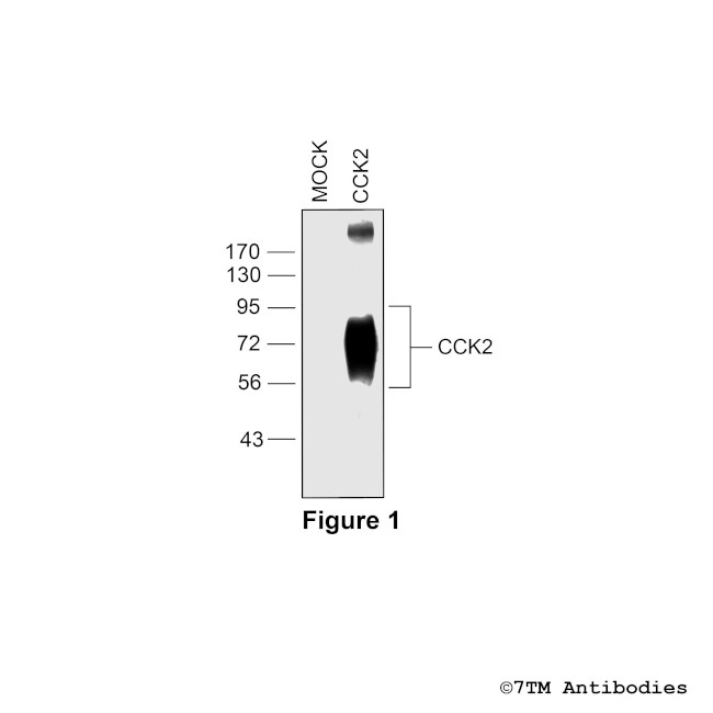 CCK2, Cholecystokinin Receptor 2 Antibody in Western Blot (WB)