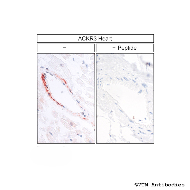 ACKR3, Atypical Chemokine Receptor 3 Antibody in Immunohistochemistry (Paraffin) (IHC (P))