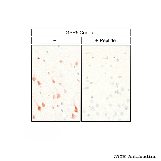 GPR6, G Protein-Coupled Receptor 6 Antibody in Immunohistochemistry (Paraffin) (IHC (P))