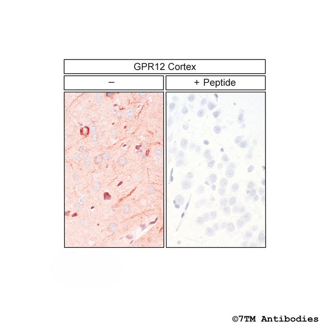 GPR12, G Protein-Coupled Receptor 12 Antibody in Immunohistochemistry (Paraffin) (IHC (P))