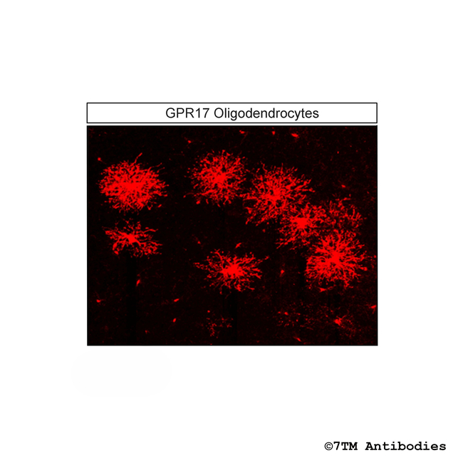 GPR17, G Protein-Coupled Receptor 17 Antibody in Immunohistochemistry (Paraffin) (IHC (P))
