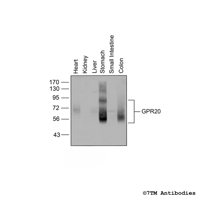 mGPR20 (G Protein-Coupled Receptor 20) Antibody in Western Blot (WB)