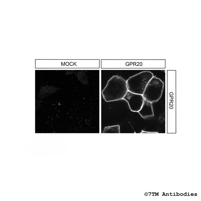 mGPR20 (G Protein-Coupled Receptor 20) Antibody in Immunocytochemistry (ICC/IF)