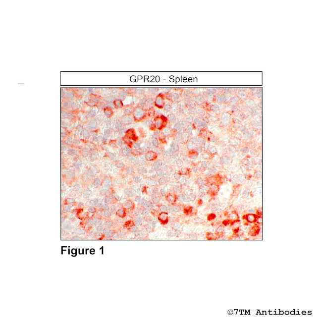 GPR20, G Protein-Coupled Receptor 20 Antibody in Immunohistochemistry (Paraffin) (IHC (P))