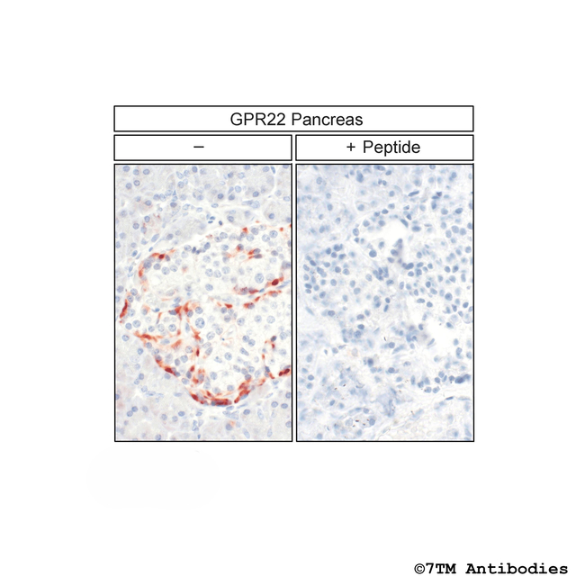 GPR22, G Protein-Coupled Receptor 22 Antibody in Immunohistochemistry (Paraffin) (IHC (P))