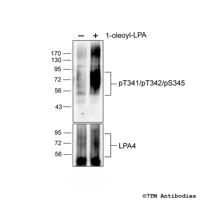 Phospho-Lysophosphatidic Acid Receptor 4 (Thr341, Thr342, Ser345) Antibody in Western Blot (WB)