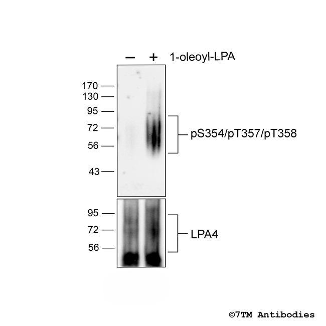 Phospho-Lysophosphatidic Acid Receptor 4 (Ser354, Thr357, Thr358) Antibody in Western Blot (WB)