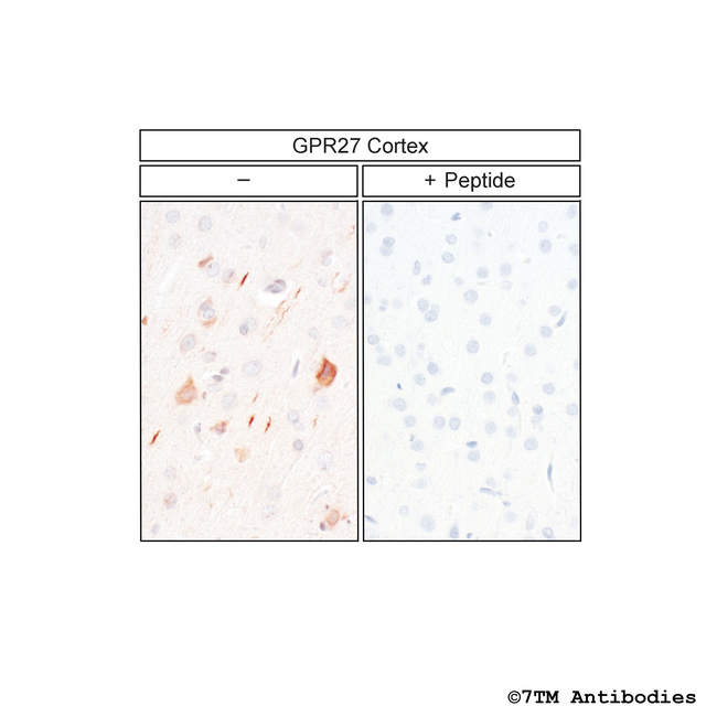 GPR27, G Protein-Coupled Receptor 27 Antibody in Immunohistochemistry (Paraffin) (IHC (P))
