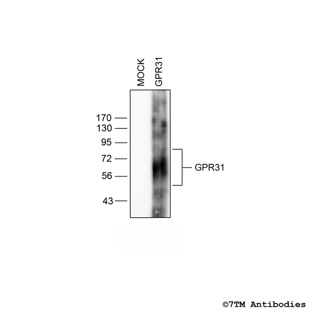GPR31, G protein-coupled Receptor 31 Antibody in Western Blot (WB)