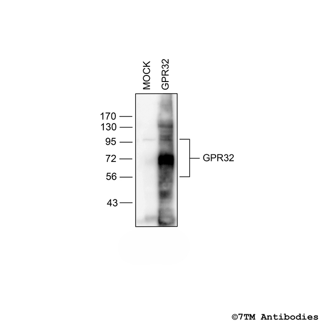 GPR32, G protein-coupled Receptor 32 Antibody in Western Blot (WB)