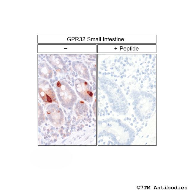 GPR32, G Protein-Coupled Receptor 32 Antibody in Immunohistochemistry (Paraffin) (IHC (P))