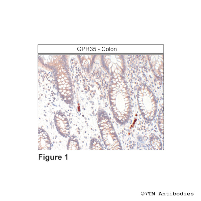 GPR35, GPR35 Receptor Antibody in Immunohistochemistry (Paraffin) (IHC (P))