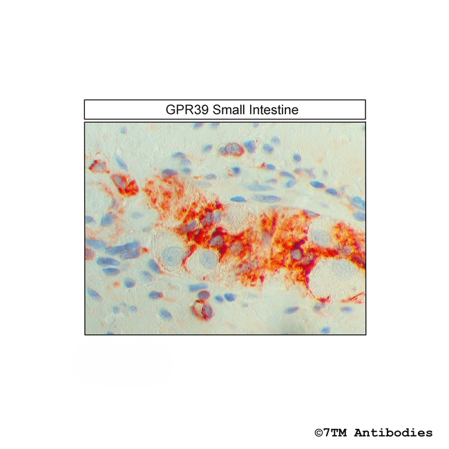 GPR39, G Protein-Coupled Receptor 39 Antibody in Immunohistochemistry (Paraffin) (IHC (P))