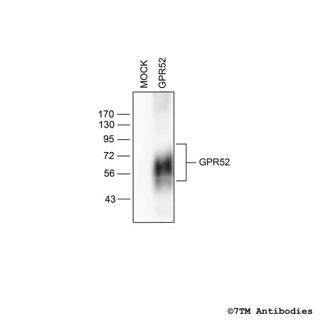 GPR52, G protein-coupled Receptor 52 Antibody in Western Blot (WB)