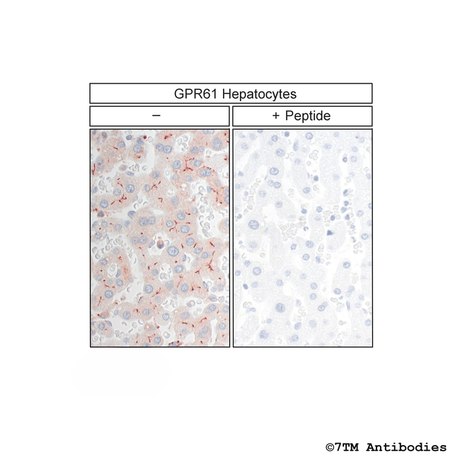 GPR61, G Protein-Coupled Receptor 61 Antibody in Immunohistochemistry (Paraffin) (IHC (P))