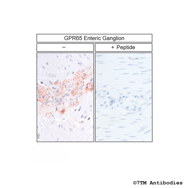 GPR65, G Protein-Coupled Receptor 65 Antibody in Immunohistochemistry (Paraffin) (IHC (P))