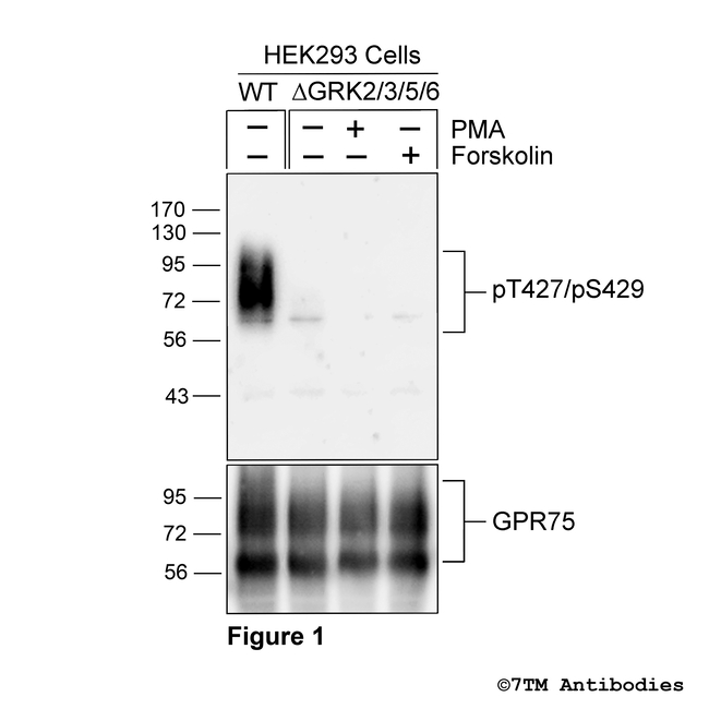 Phospho-GPR75 (Thr427, Ser429) Antibody in Western Blot (WB)