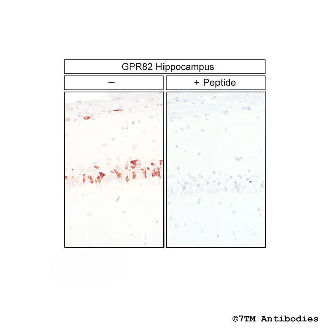 GPR82, G Protein-Coupled Receptor 82 Antibody in Immunohistochemistry (Paraffin) (IHC (P))