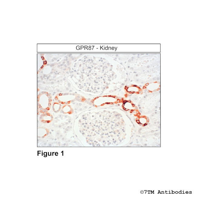 GPR87, G Protein-Coupled Receptor 87 Antibody in Immunohistochemistry (Paraffin) (IHC (P))