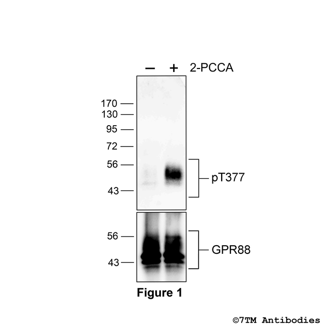 Phospho-GPR88 (Thr377) Antibody in Western Blot (WB)