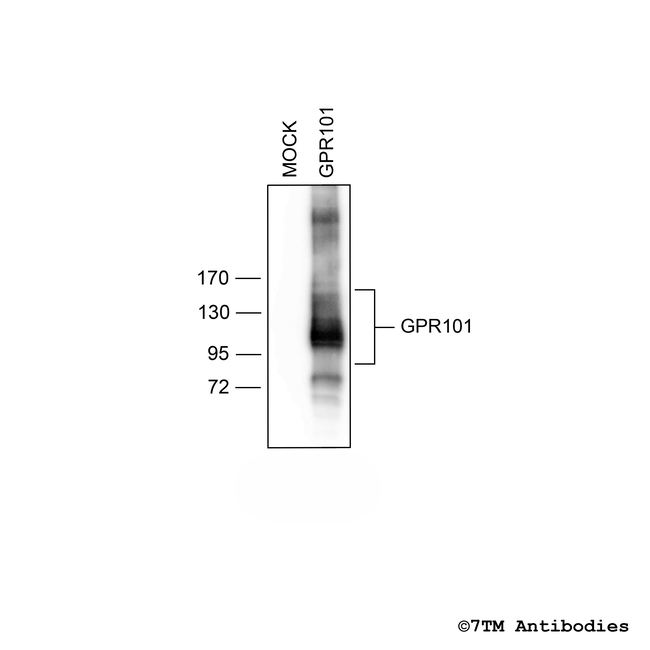 GPR101, G protein-coupled Receptor 101 Antibody in Western Blot (WB)