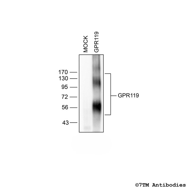 GPR119, G protein-coupled Receptor 119 Antibody in Western Blot (WB)