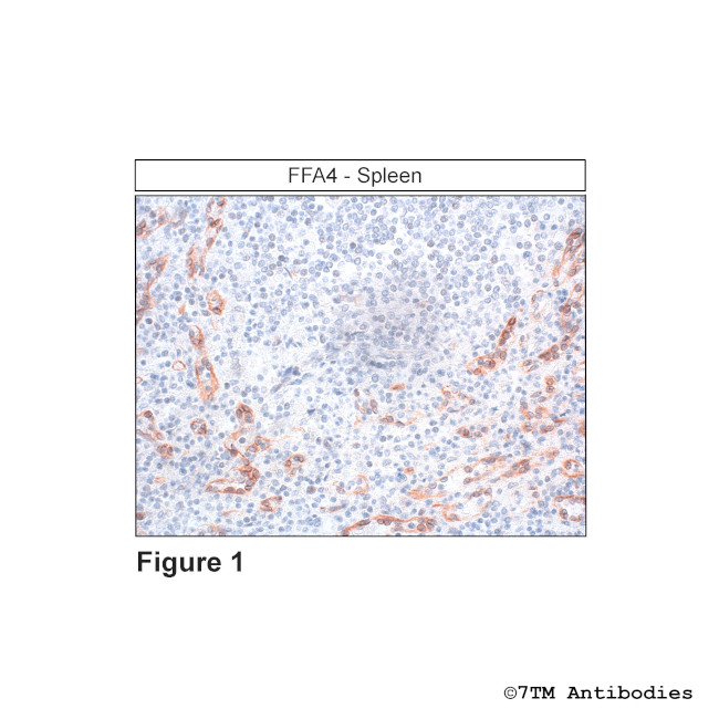 FFA4, FFA4 Receptor Antibody in Immunohistochemistry (Paraffin) (IHC (P))
